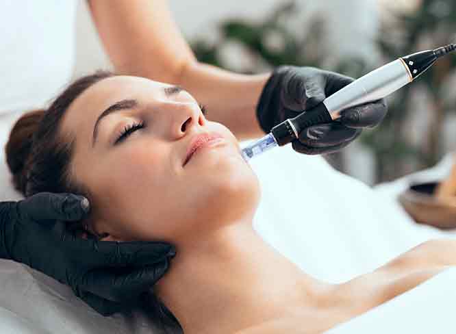 Formation Microneedling